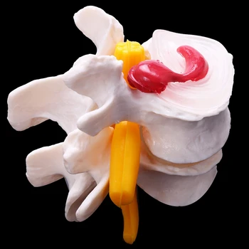 2X Човешка анатомия Скелет Гръбначен стълб 4-степени Лумбален гръбначен модел Мозък Череп Травматични учебни пособия 2